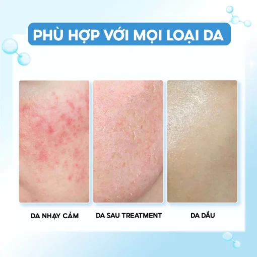 serum Timeless Hyaluronic Acid 100% phù hợp với mọi loại da