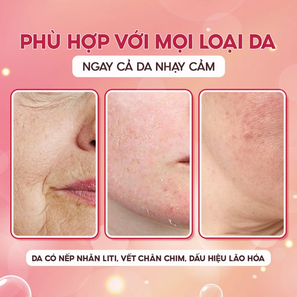 Phù hợp với mọi loại da Timeless Matrixyl®️ Synthe'6®️